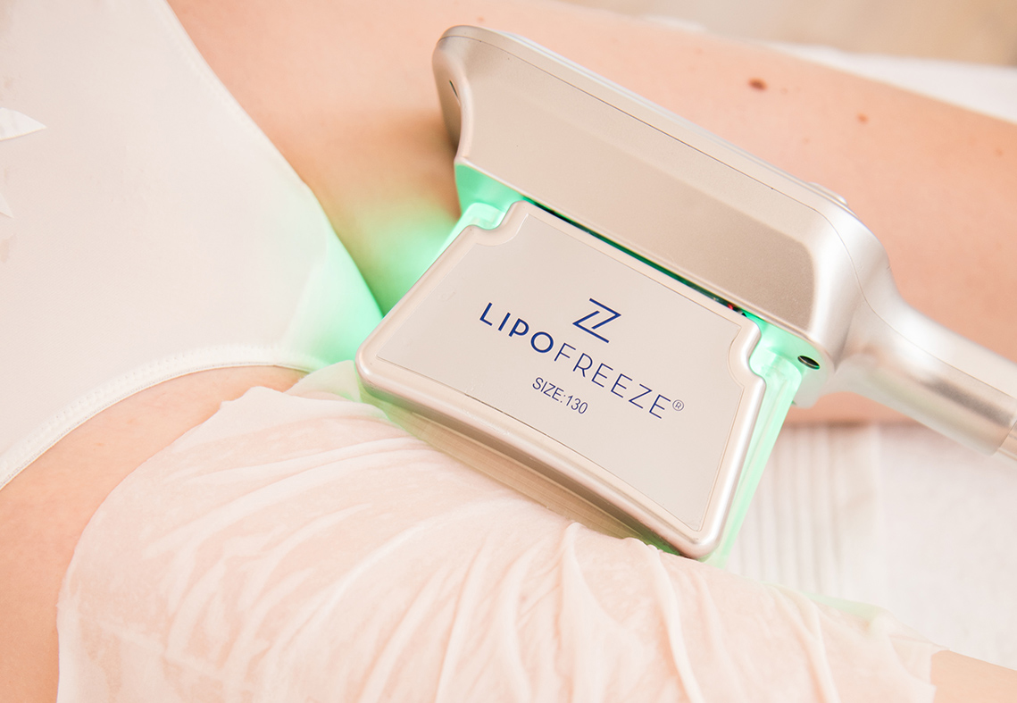 lipofreeze strasbourg